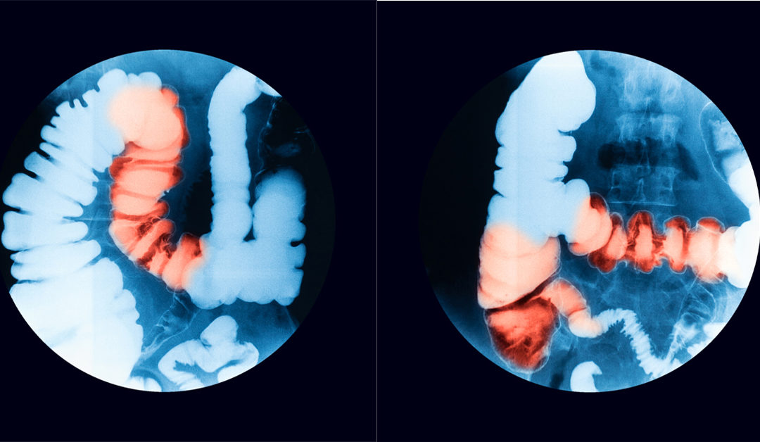 Fluoroscopy