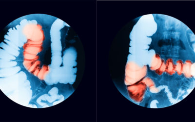 Fluoroscopy